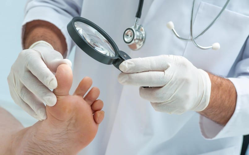 bunion surgery options